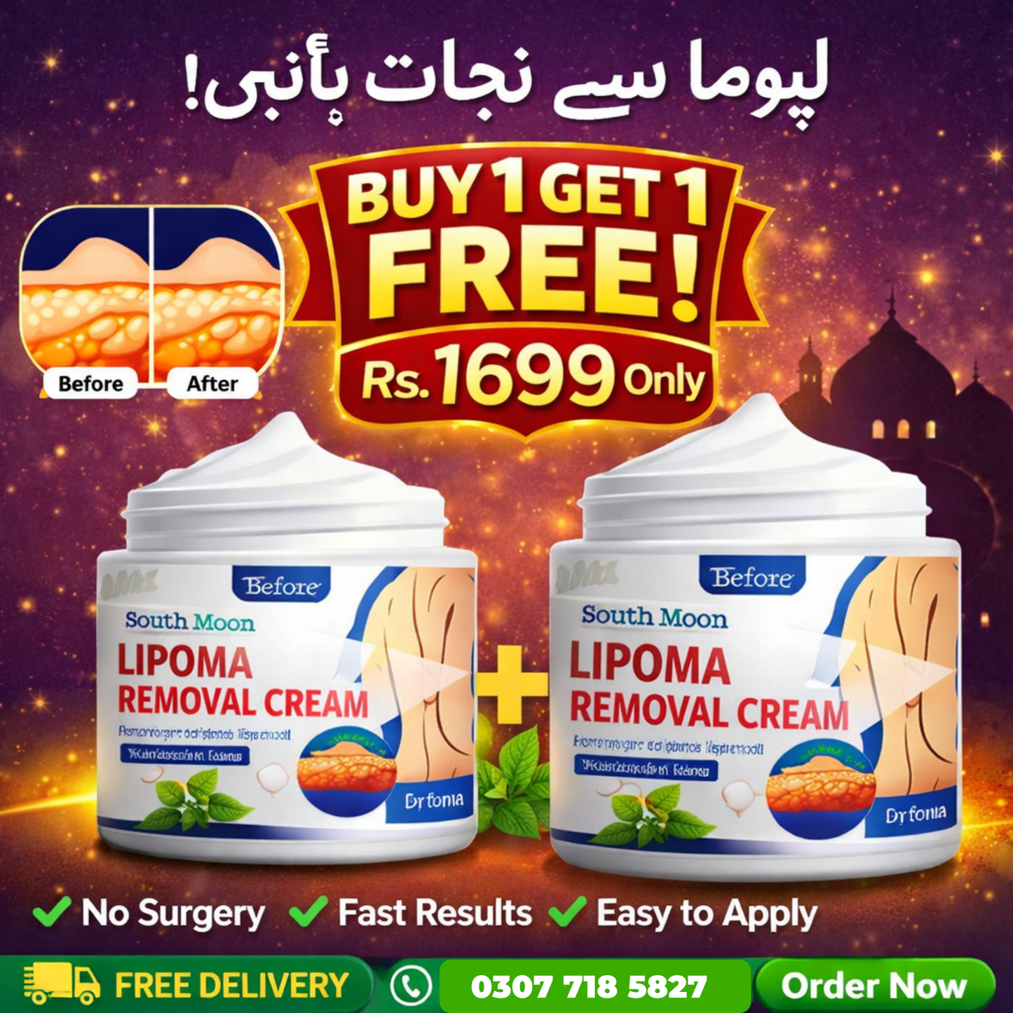South Moon Lipoma Removal Cream – Herbal Extract Essence Skin Care Treatment (50g)