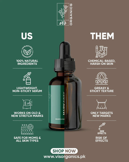 Mark Away – Stretch Mark Remover Serum