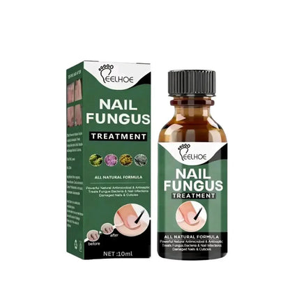 Nail Fungus Treatment Serum 10ml